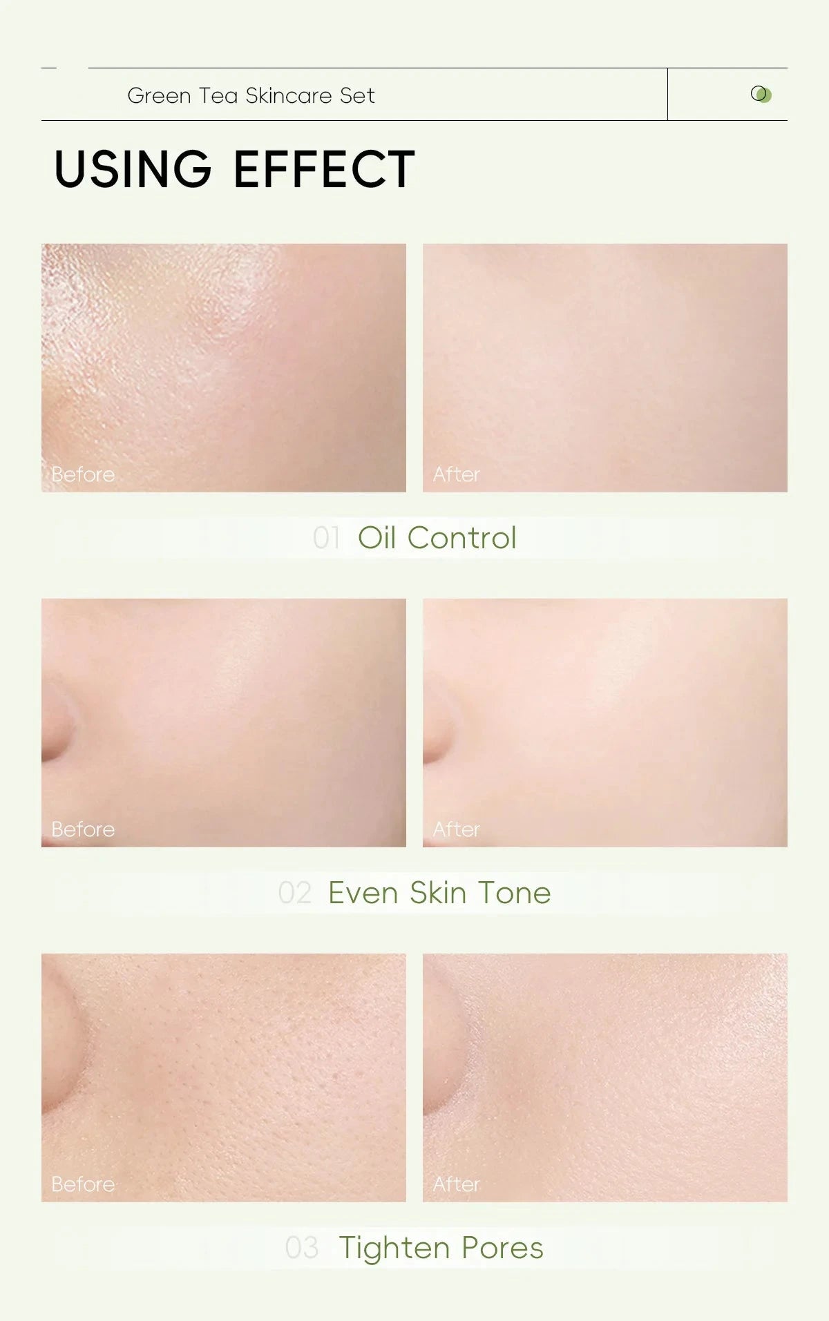 5-Piece Green Tea Skincare Set