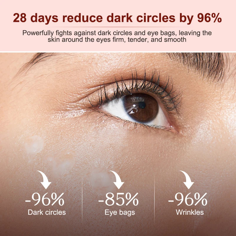 Astaxanthin Eye Cream Dark Circle Remover Eye Bags Anti Wrinkle Firming Moisturizing Eye Serum 20g