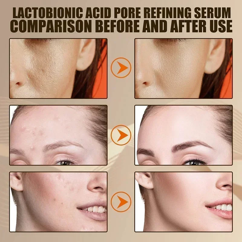 Lactobionic Acid & Ceramide Facial Serum - 30ml