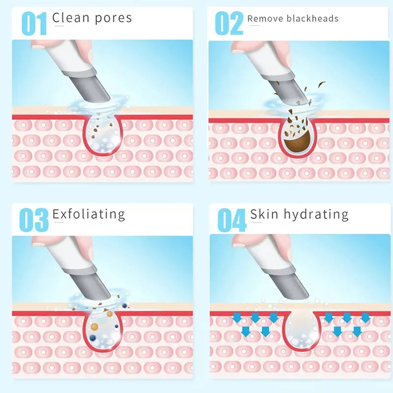 Oxygen Injection and Small Bubble Peeling Beauty Device | Aqua Facial Cleansing & Blackhead Suction