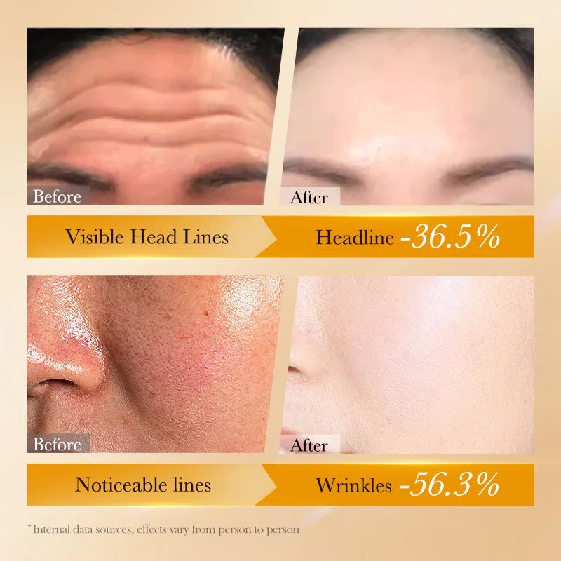 Kit de cuidado de la piel antiarrugas con péptidos de retinol de Corea: calidad superior