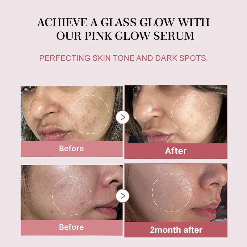Pink Glow Salmon PDRN Collagen Peptide Serum 30ml | Brightening, Firming &amp; Deep Hydration