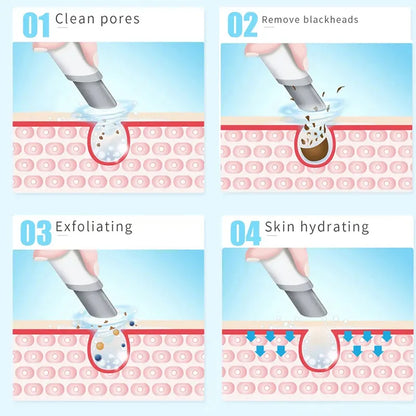 Oxygen Injection and Small Bubble Peeling Beauty Device | Aqua Facial Cleansing & Blackhead Suction